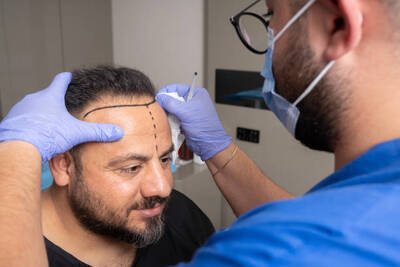 ギャラリー｜Hair Transplant Prices in Riyadh