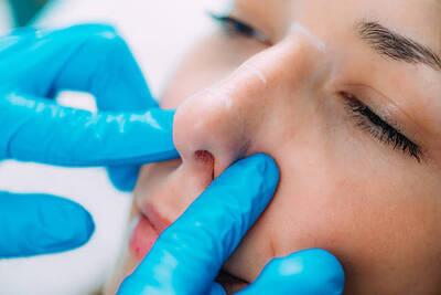 ギャラリー｜Rhinoplasty in Riyadh