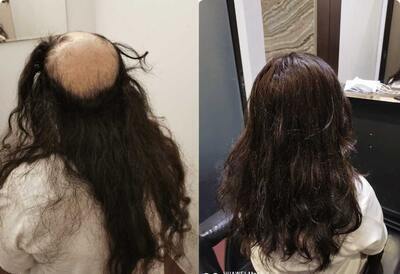 プロフィール｜Hair Replacement Singapore